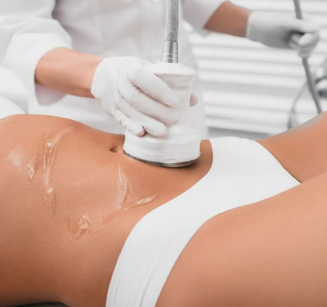 LipoActive - Cavitación