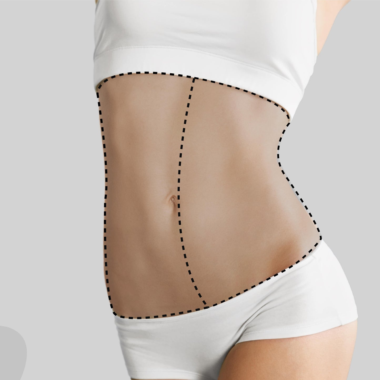 Medio abdomen
