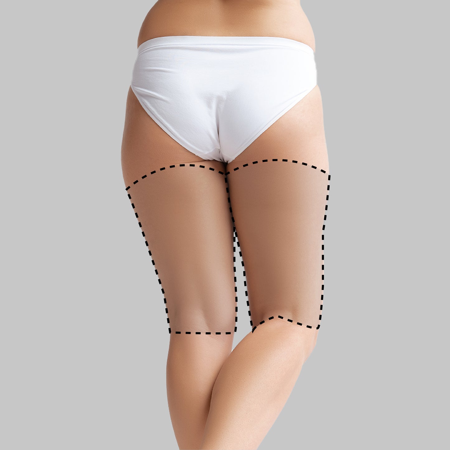 Femoral