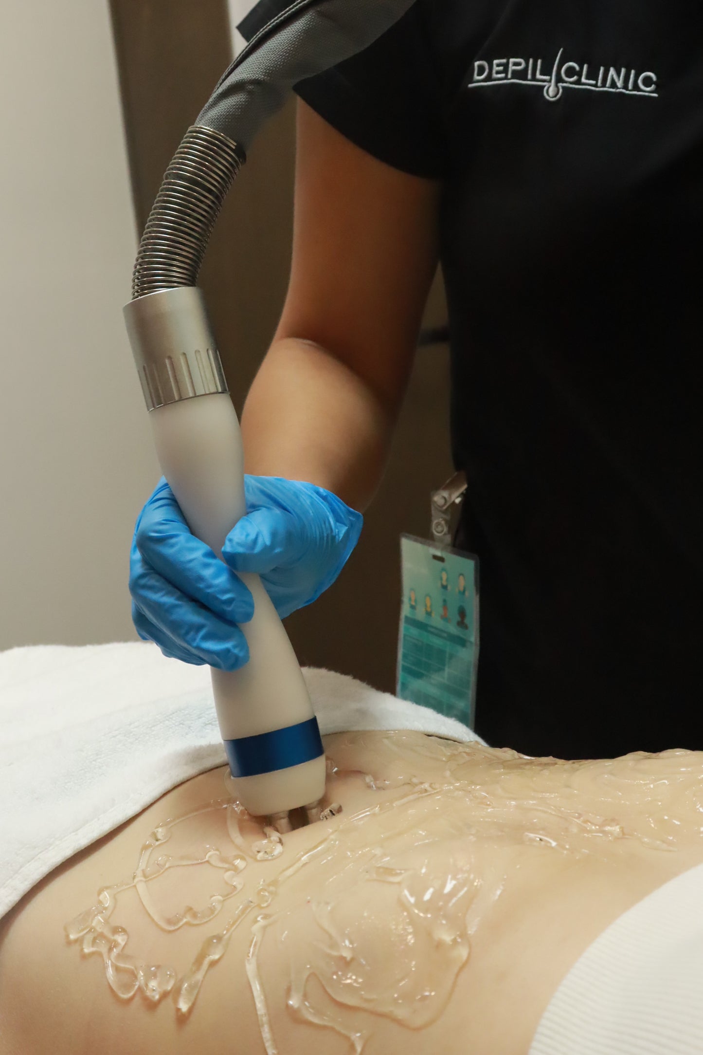 Tratamiento de radiofrecuencia corporal