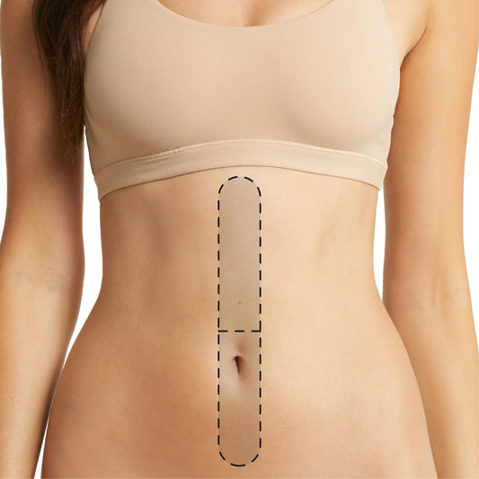 Media línea abdomen
